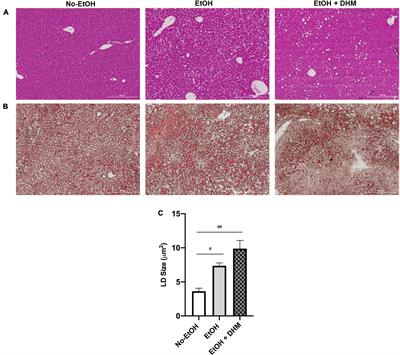 Dihydromyricetin supplementation improves ethanol-induced lipid accumulation and inflammation